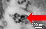 Black inclusions in placental cells resembling inhaled particulate matter (on a scale of nanometres)