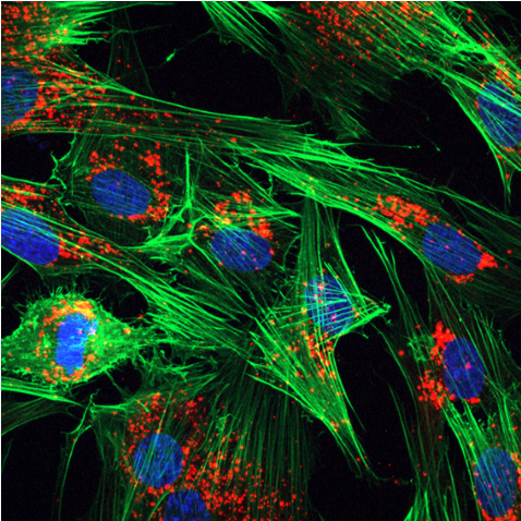 Barts Metabolism Network