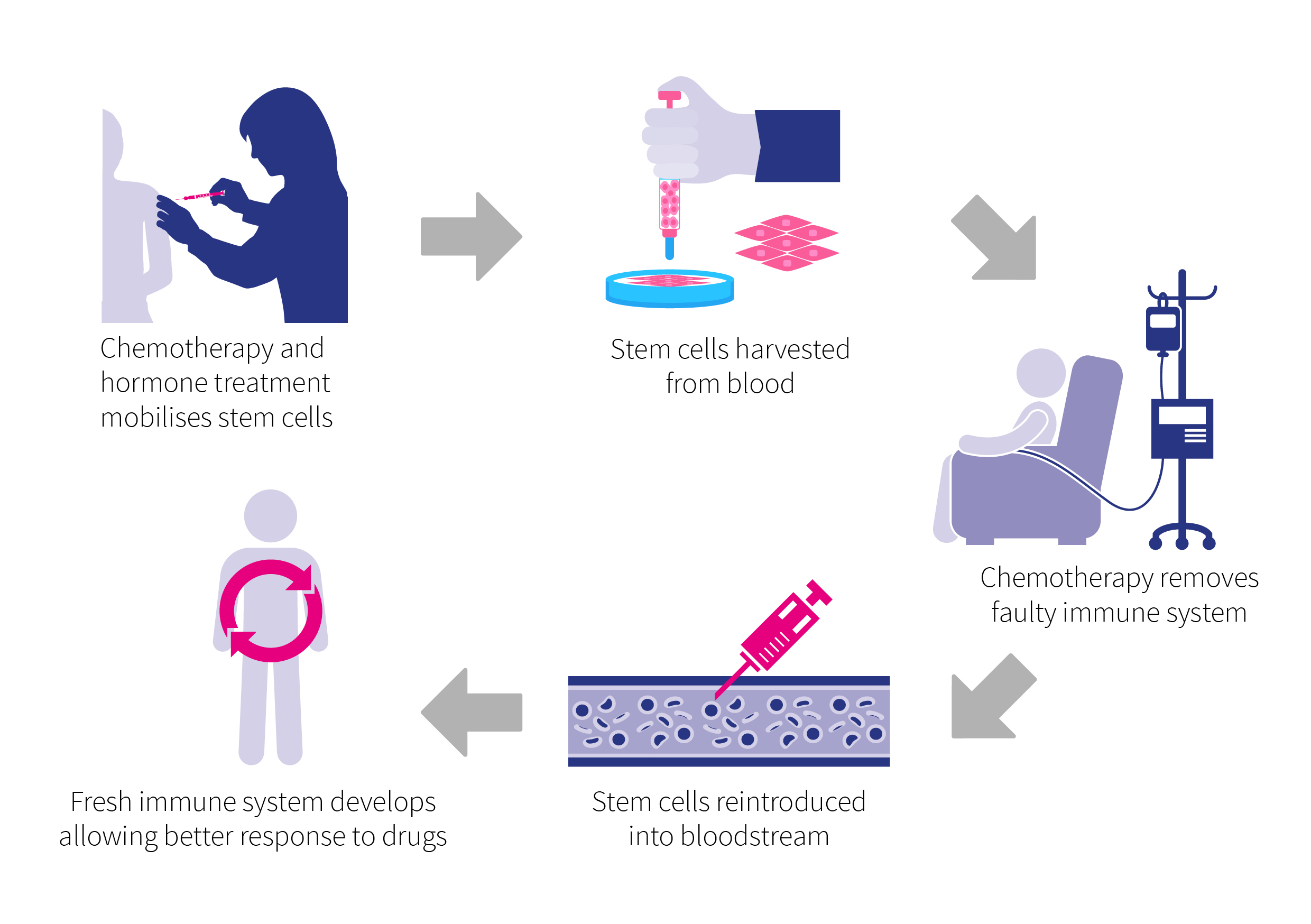 Stem Cell Transplant for Crohn's Disease