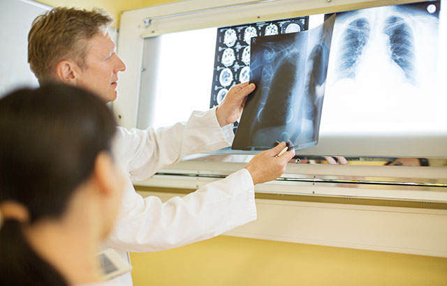 Professor Stephen Duffy, Professor of Cancer Screening at the Wolfson Institute of Preventive Medicine, and Professor John Field, from the University of Liverpool’s Department of Molecular and Clinical Cancer Medicine, comment on recently published results from a lung cancer screening trial.