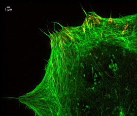 Focal adhesions and actin