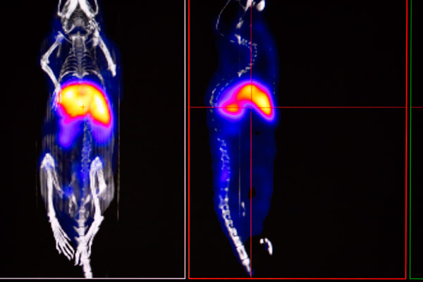 Non-invasive imaging