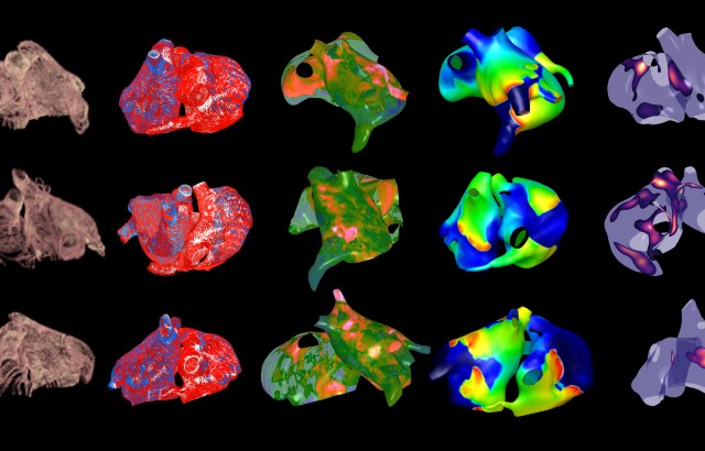 Atrial Digital Twins. Credit: Caroline Roney.