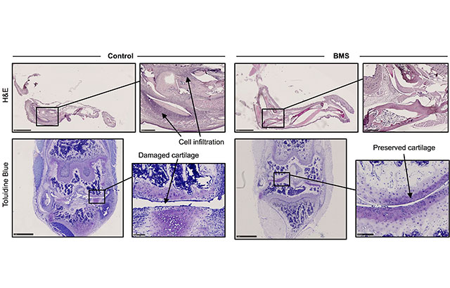 Arthritic were mice treated with either BMS or control saline