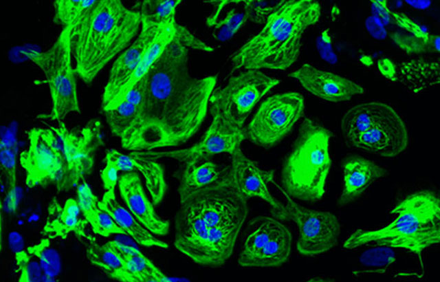 Cardiomyocytes-derived-from-human-iPSCs-640