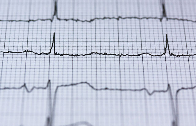 Electrocardiodiagram