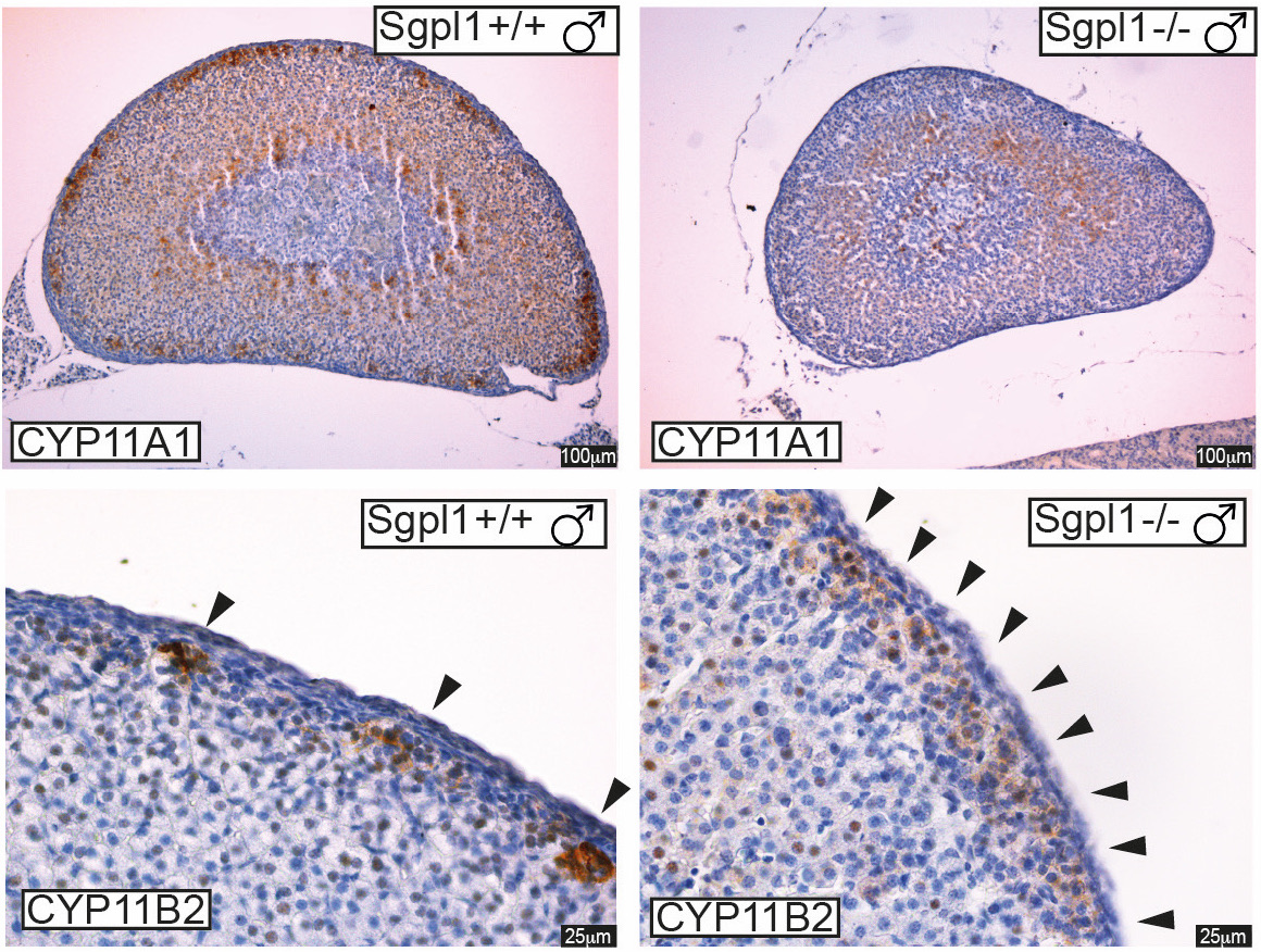 Genetic defect found to cause disease in multiple organs