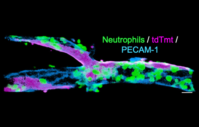 The image depicts a postcapillary venule subjected to acute inflammation and captures  neutrophils (green) transmigrating across endothelial cells junctions (blue).  Neutrophils preferably migrate across contacts between autophagy deficient endothelial cells (magenta).