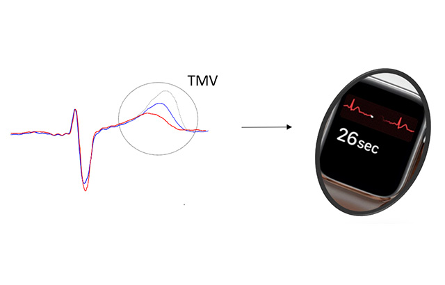 T- wave morphology variations on the ECG signal could enable large-scale screening to predict SCD risk using smartwatches.