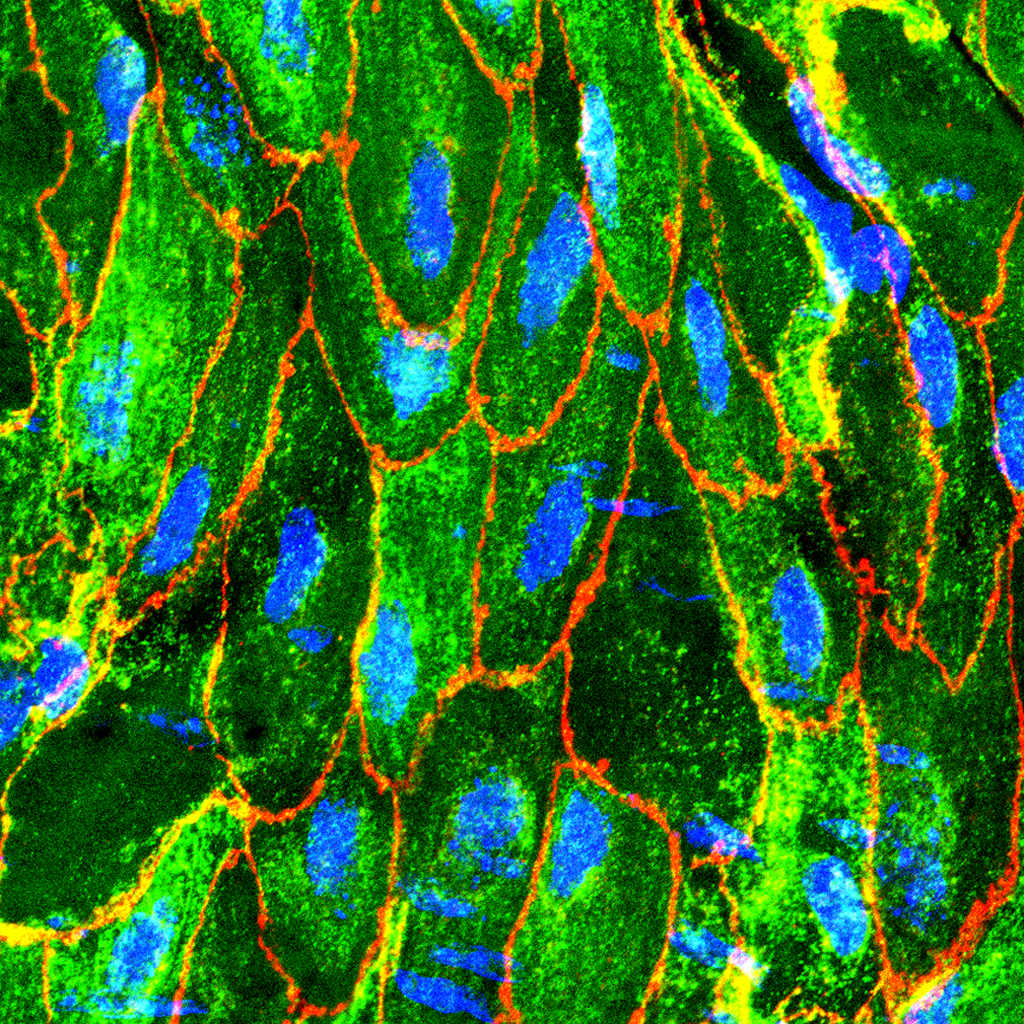 immunostaining visualising the endothelium of a mouse aorta