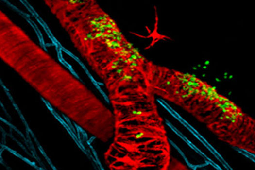 Microvascular Research