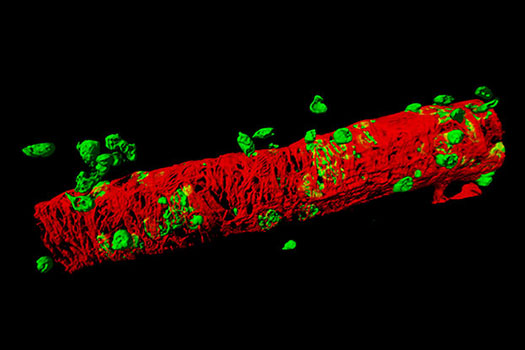 Inflammation Research 