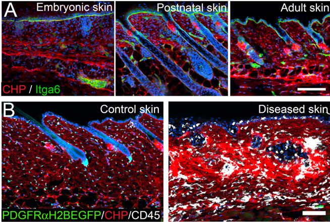 Figure 3: Investigating fibroblast collagen deposition and remodelling during skin development and disease.  (A) Collagen fibres (red) start to appear in reticular dermis during embryonic development and collagen signal increases with age. (B) Fibrotic (diseased) skin is characterised by strong immune cell infiltration (CD45, white) and  increased collagen deposition/remodelling.