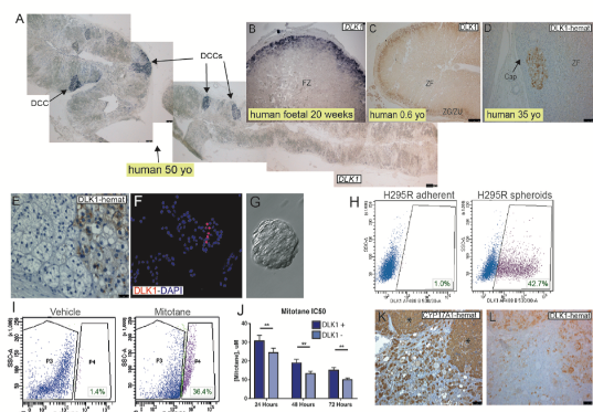 The role of DLK1