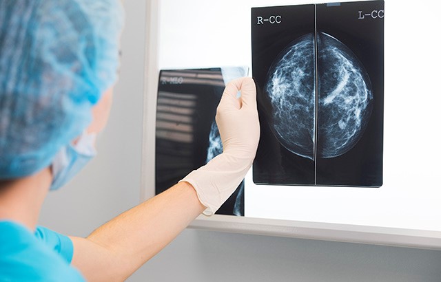 A doctor inspects a patient's mammograms